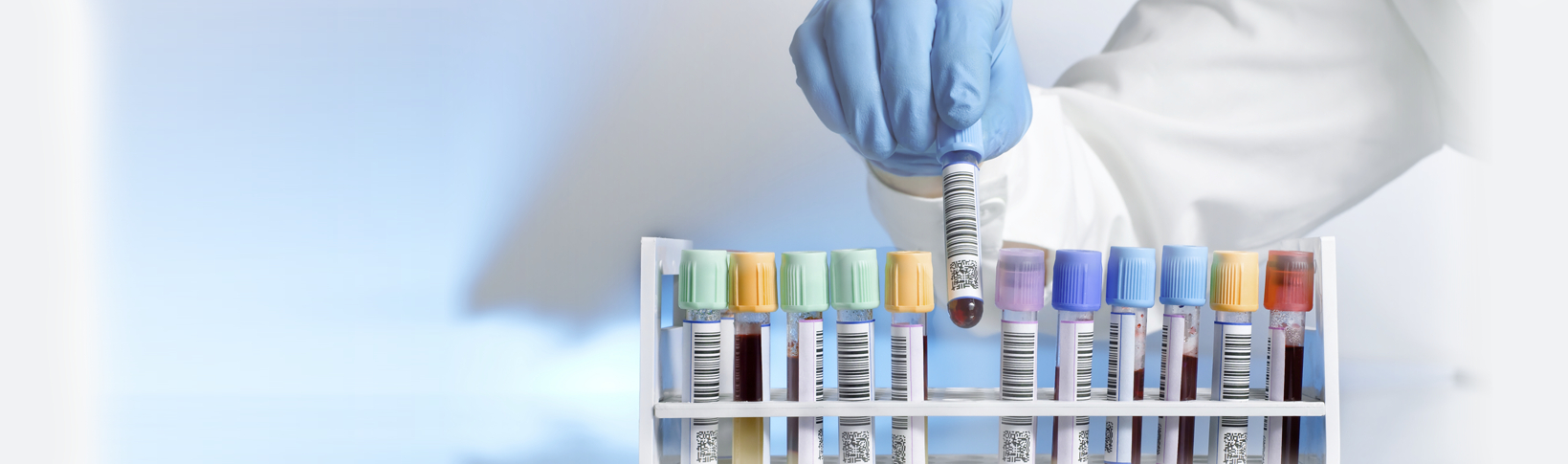 Test tube tray