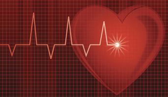 Cardiac monitoring graphic