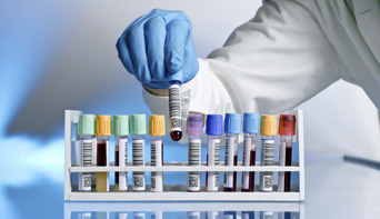 Test tubes